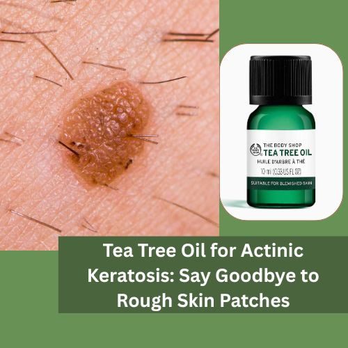 Tea Tree Oil for Actinic Keratosis: Say Goodbye to Rough Skin Patches