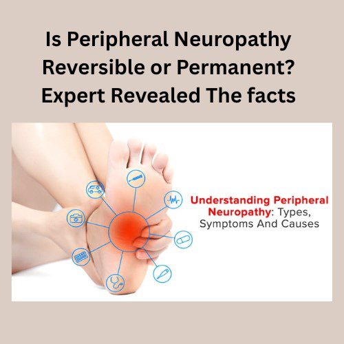 Is Peripheral Neuropathy Reversible or Permanent? Expert Revealed the Facts - Herbal Care Products - Blog