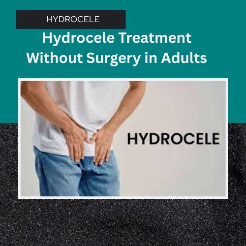 Effective Hydrocele Treatment Without Surgery in Adults: New Hope for Men - Herbal Care Products - Blog