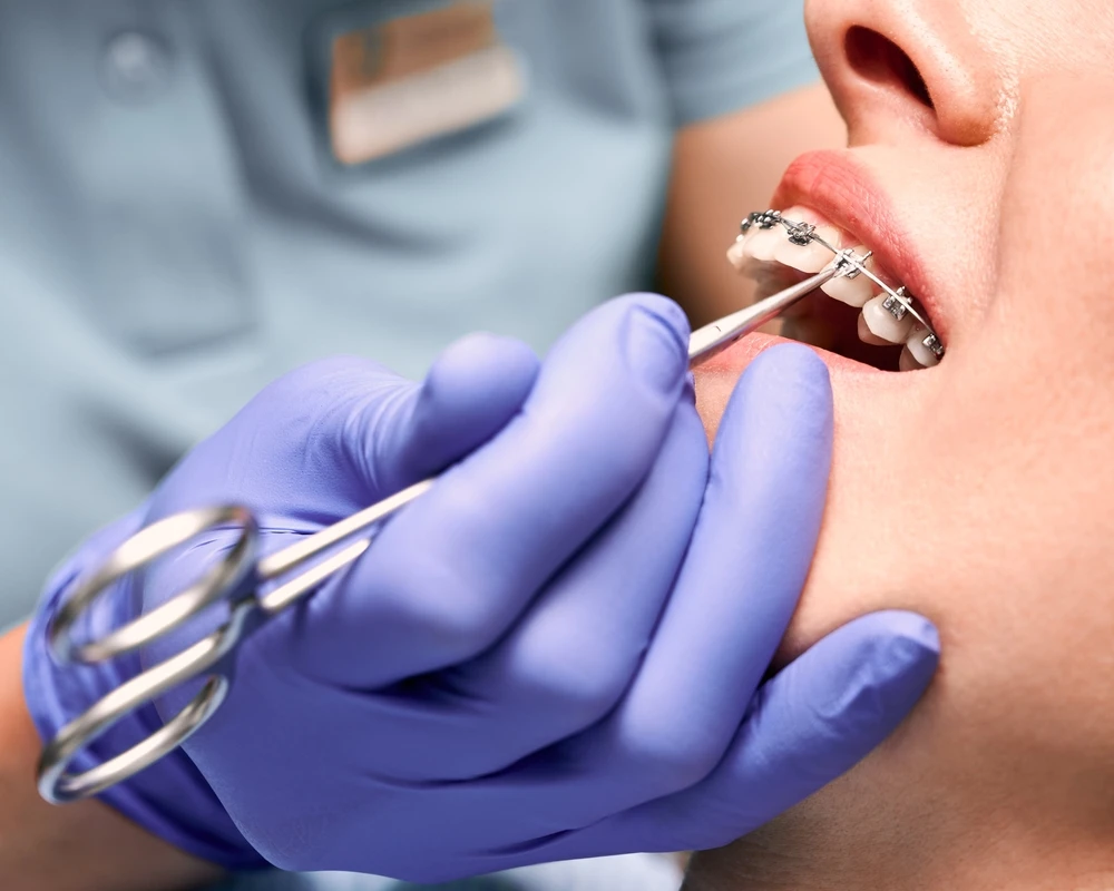 How Orthodontic Treatment Can Transform Your Smile in Oakville