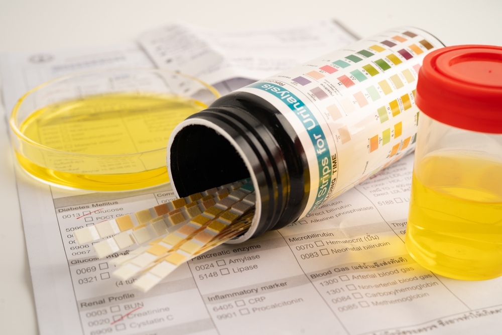 Expert Care Trouble Urinating Treatment in Van Nuys, CA