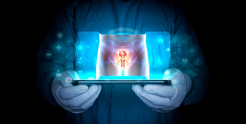 Peyronie’s Disease Treatment & Wave Therapy in Burlington