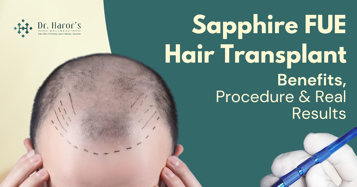 Sapphire FUE Hair Transplant: Benefits, Procedure & Real Results