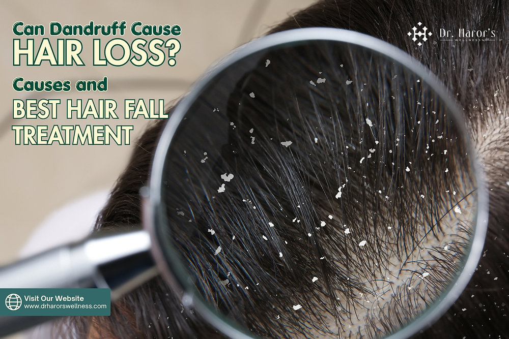 Can Dandruff Cause Hair Loss? Causes and Best Hair Fall Treatment