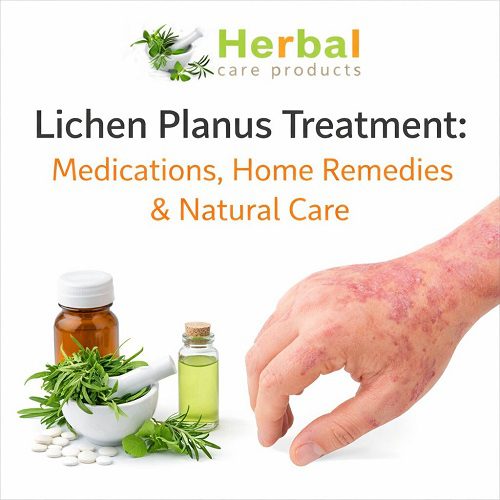Lichen Planus Treatment: Medications, Home Remedies & Natural Care