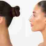 Rhinoplasty in Riyadh Profile Picture