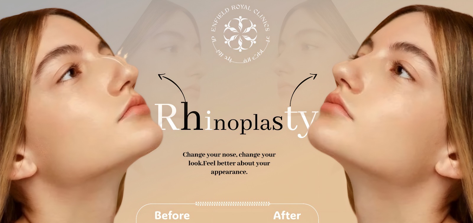 Rhinoplasty in Islamabad & Best Nose Reshaping - RCS