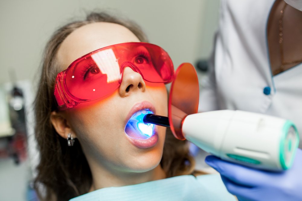 Laser Gum Contouring in Falls Church: The Complete Guide