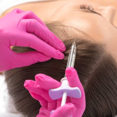 Exosomes in Islamabad | Exosomes For Hair Loss